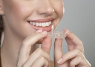 Clear Aligners