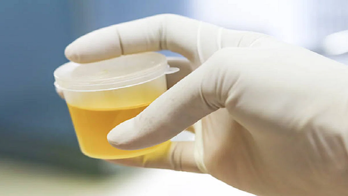 Temperature with Synthetic Urine